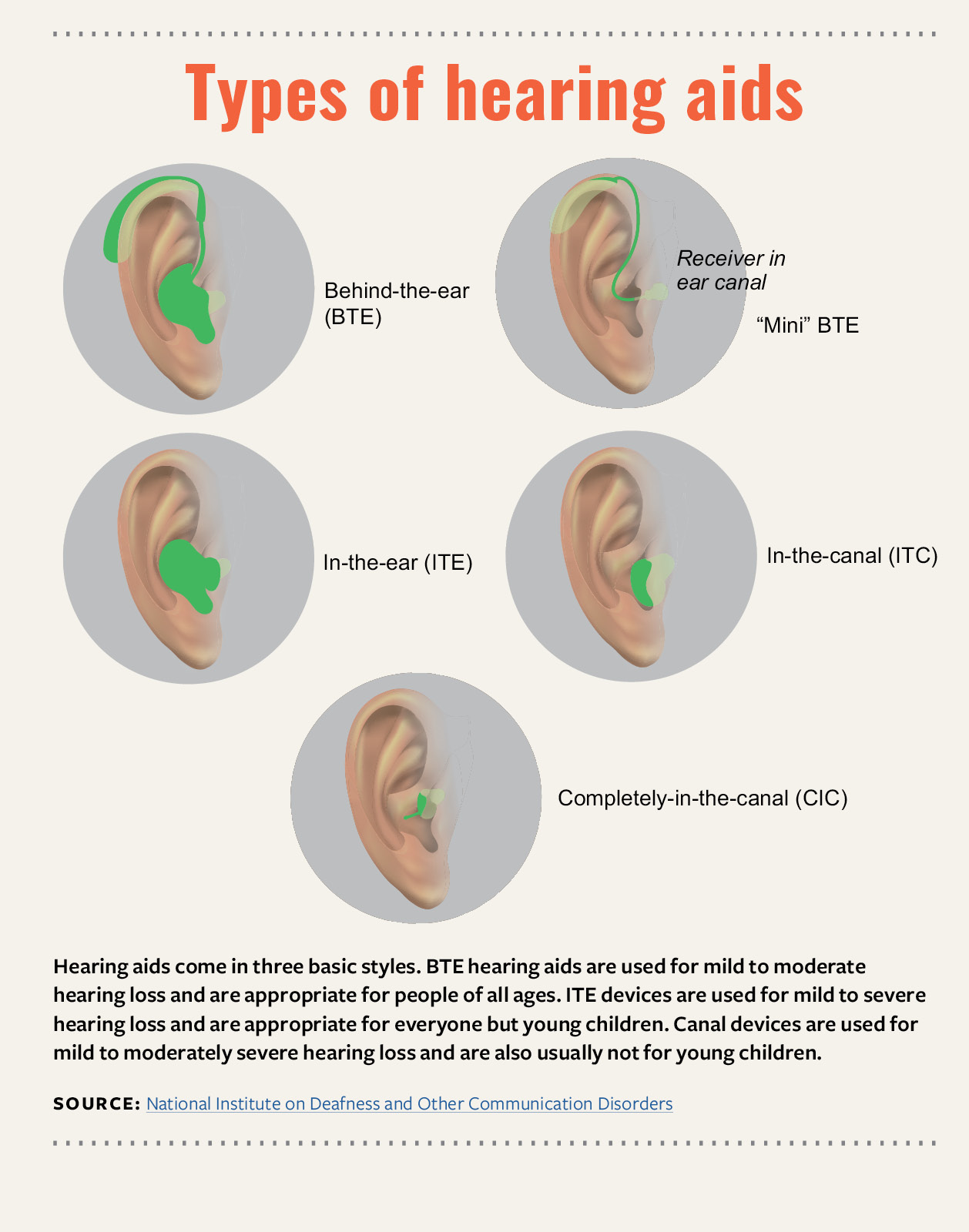 Types of Hearing Aids 