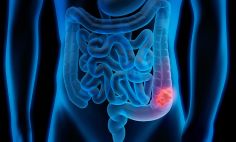 Diagrama del sistema digestivo, que incluye el colon, el recto y el ano.