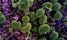 Célula (verde) muy infectada con partículas del virus del SARS-CoV-2 (púrpura). 