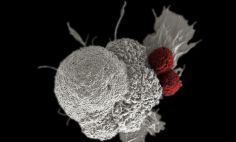 Shown here is a pseudo-colored scanning electron micrograph of an oral squamous cancer cell (white) being attacked by two cytotoxic T cells (red), part of a natural immune response. 