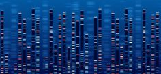 Los investigadores encontraron mutaciones en varios genes que parecen estar relacionadas con una forma más agresiva del rabdomiosarcoma (RMS) y con una menor probabilidad de supervivencia.