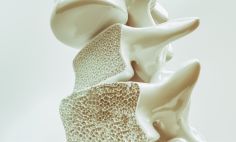 La osteoporosis puede desarrollarse si se disminuye la masa ósea o cambia la estructura de los huesos, debilitándolos y haciéndolos más propensos a romperse. 