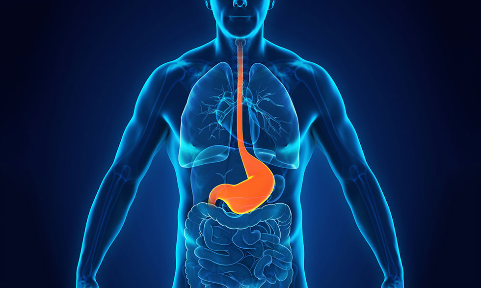 Acid reflux, Heartburn, and GERD: What’s the difference ...