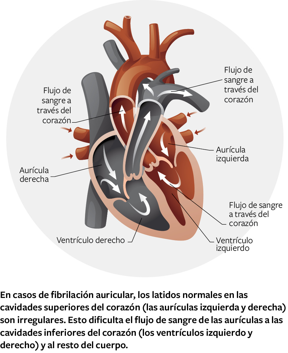 Blood flow through heart, right atrium, right ventricle, left ventricle, blood flow through heart, left atrium, blood flow through heart. In AFib, the beating in the upper chambers of the heart (the left and 
right atria) becomes irregular. This makes it harder for blood to flow 
from the atria to the lower chambers of the heart (the left and right 
ventricles) and to the rest of the body.