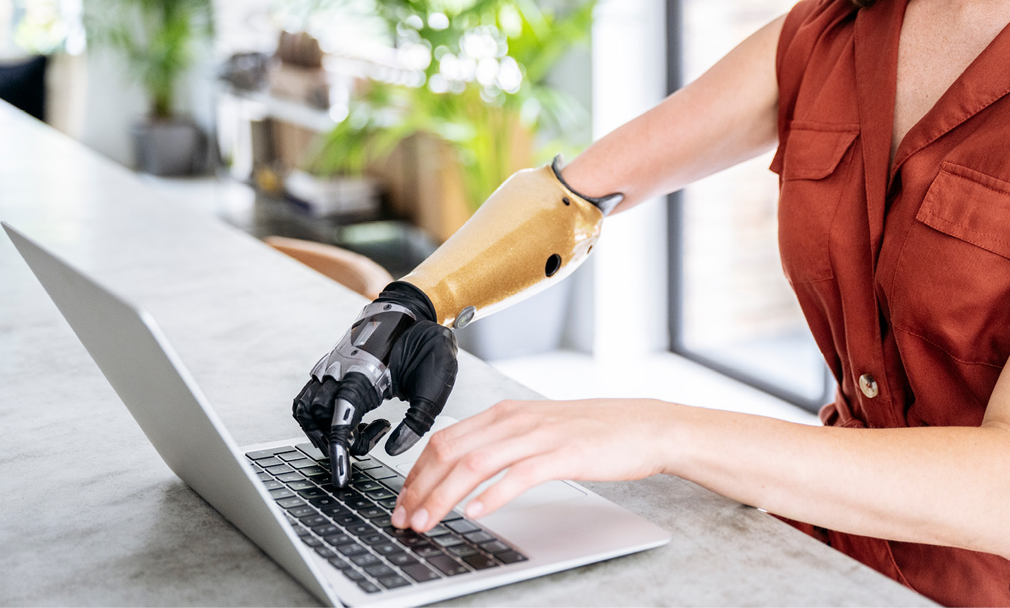 Modern bionic arm typing on a computer