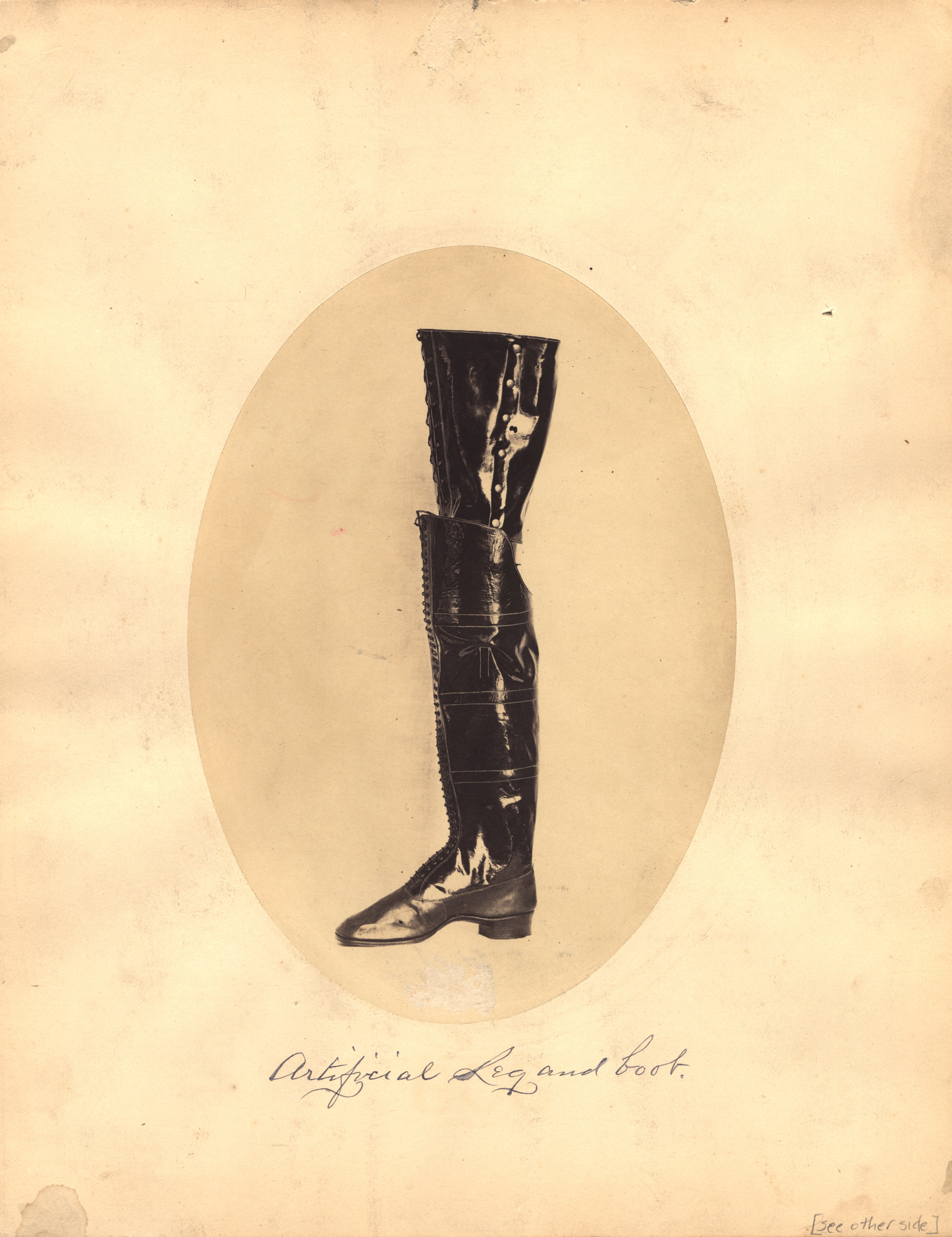 Nineteenth-century prosthetic leg
