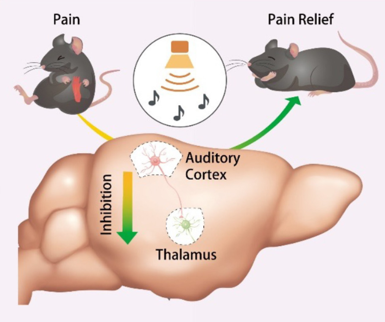 Infographic showing how sound inhibits pain signaling in mice’s brains.  