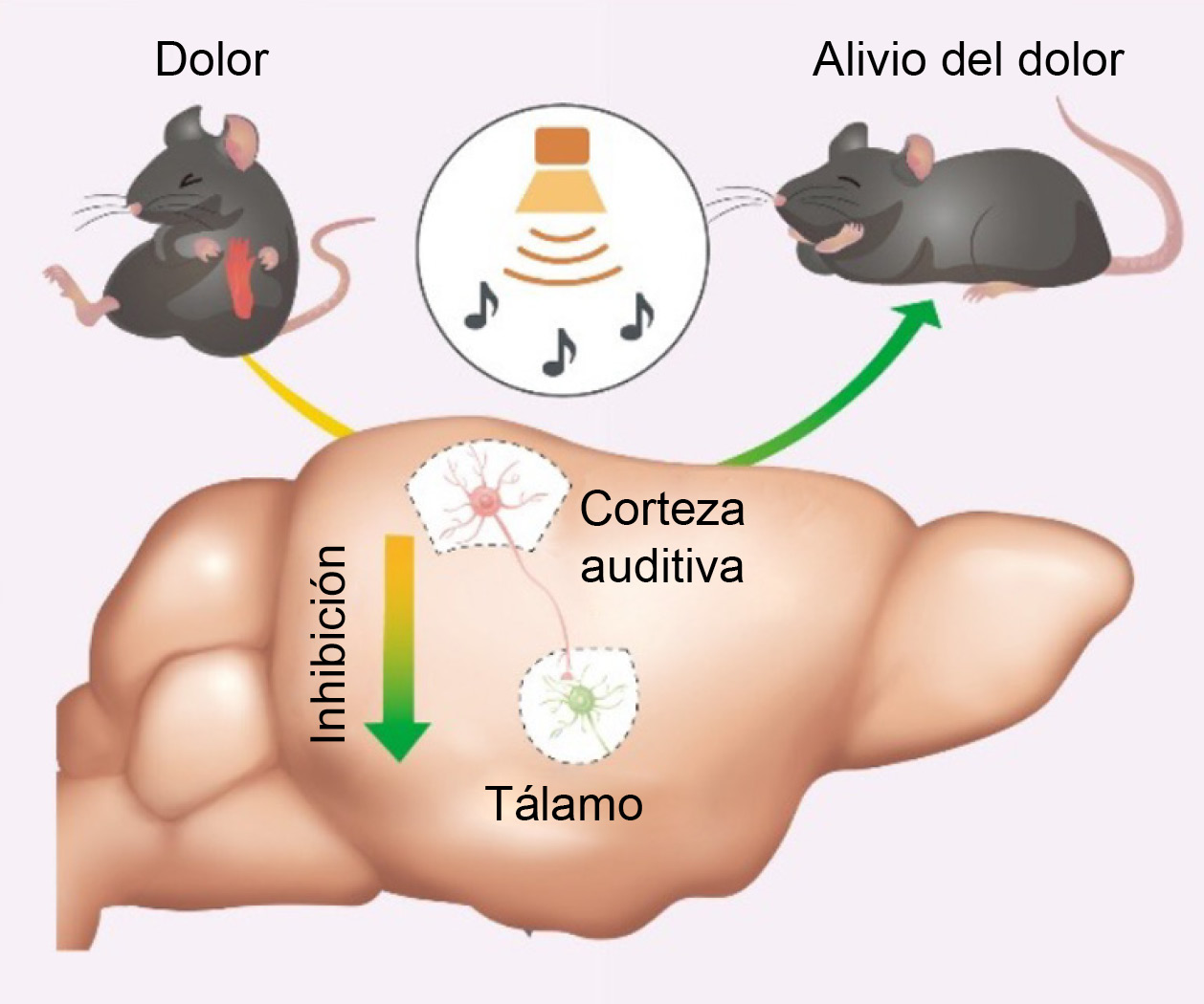 Infográfica que muestra cómo el sonido interrumpe las señales del dolor en el cerebro de los ratones.  